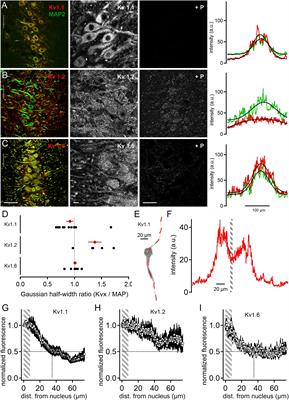 Distinct Distribution Patterns of Potassium Channel Sub-Units in Somato-Dendritic Compartments of Neurons of the Medial Superior Olive